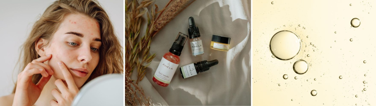 Koláž pleti s akné, produktů přírodní kosmetiky Anela a detailní textury pleťového oleje s bublinkami.