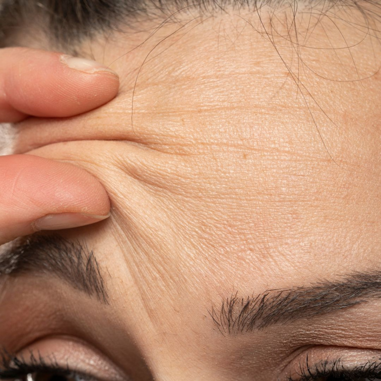 Stárnutí pleti a vrásky na čele v detailu – ukázka potřeby hloubkové hydratace a přírodní omlazující péče