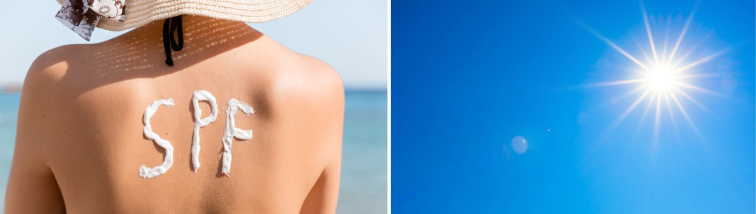 Dvoudílná koláž ženy na pláži s nápisem SPF z opalovacího krému na zádech a detailu zářícího slunce na jasně modré obloze.