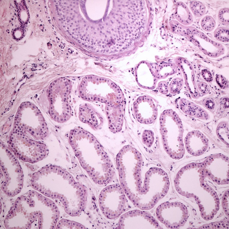 Histologický snímek pod mikroskopem zobrazující strukturu ekrinních a apokrinních potních žláz.