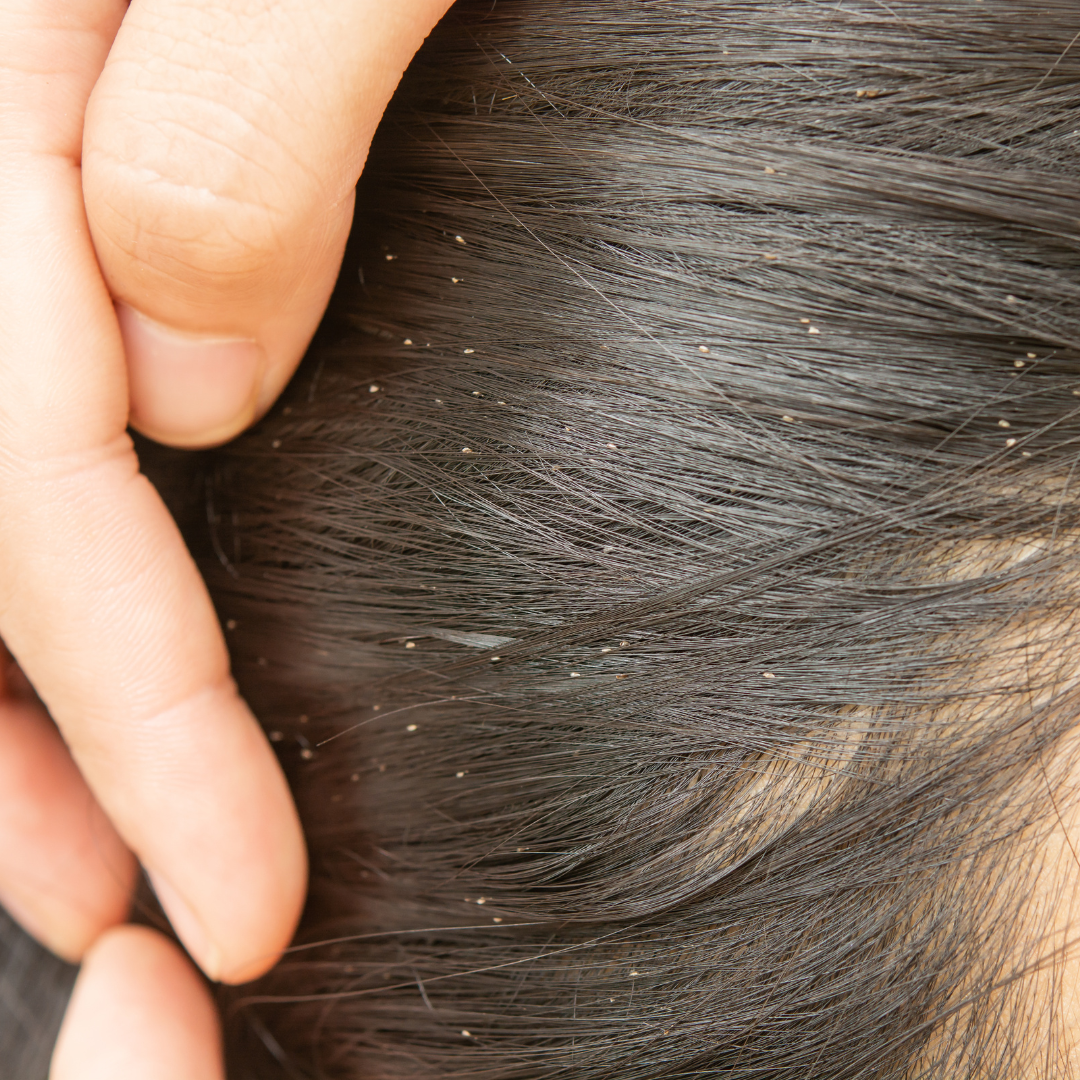 ruka se všiváčkem, pročesávájící dětské vlasy