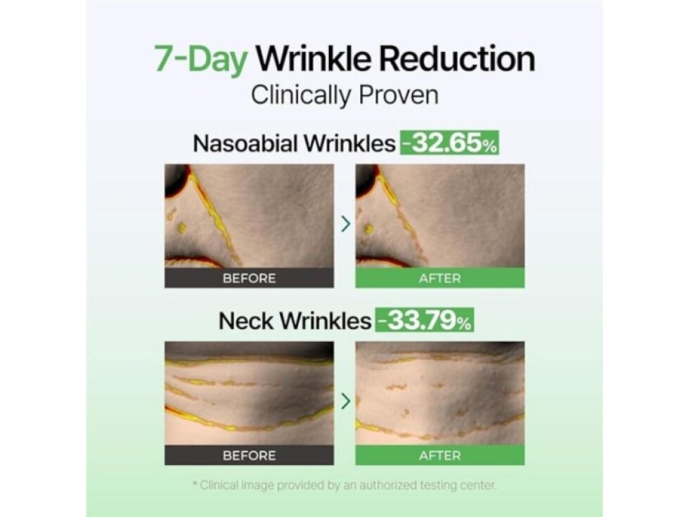 IZEZE - EXOSOME PDRN FIRMING EYE CREAM - Zpevňující a regenerační oční krém s exosomy a PDRN 30 ml