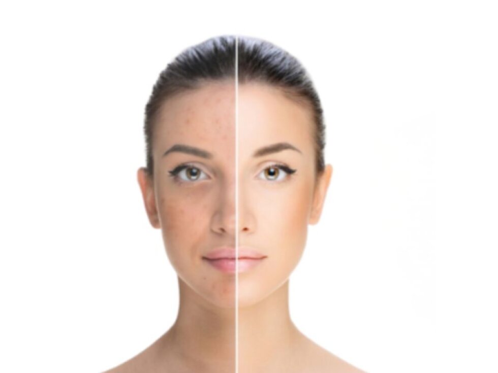 MEDITIME - MELABAN CREAM - Rozjasňující a sjednocující pleťový krém proti pigmentovým skvrnám 50 ml NOVÉ STŘÍBRNÉ BALENÍ