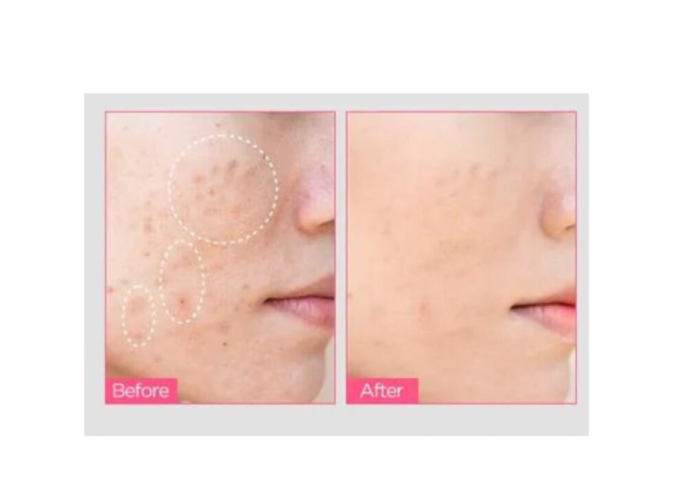 ANUA - NIACINAMIDE 10% + TXA 4% - Rozjasňující sérum proti pigmentovým skvrnám s 10 % niacinamidem a 4 % kyselinou tranexamovou 30 ml