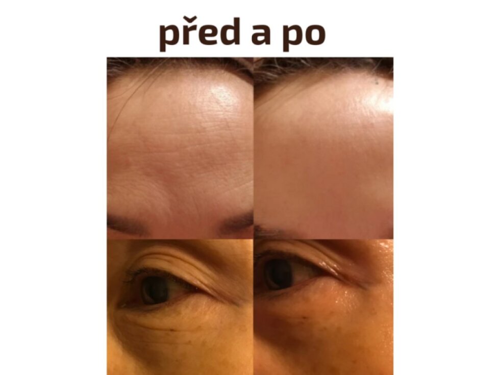 PEPPLUS+ - LIFTING UP PACK MASK - Liftingová maska s peptidy, aminokyselinami a fermenty2 měsíční kůra 8 ks