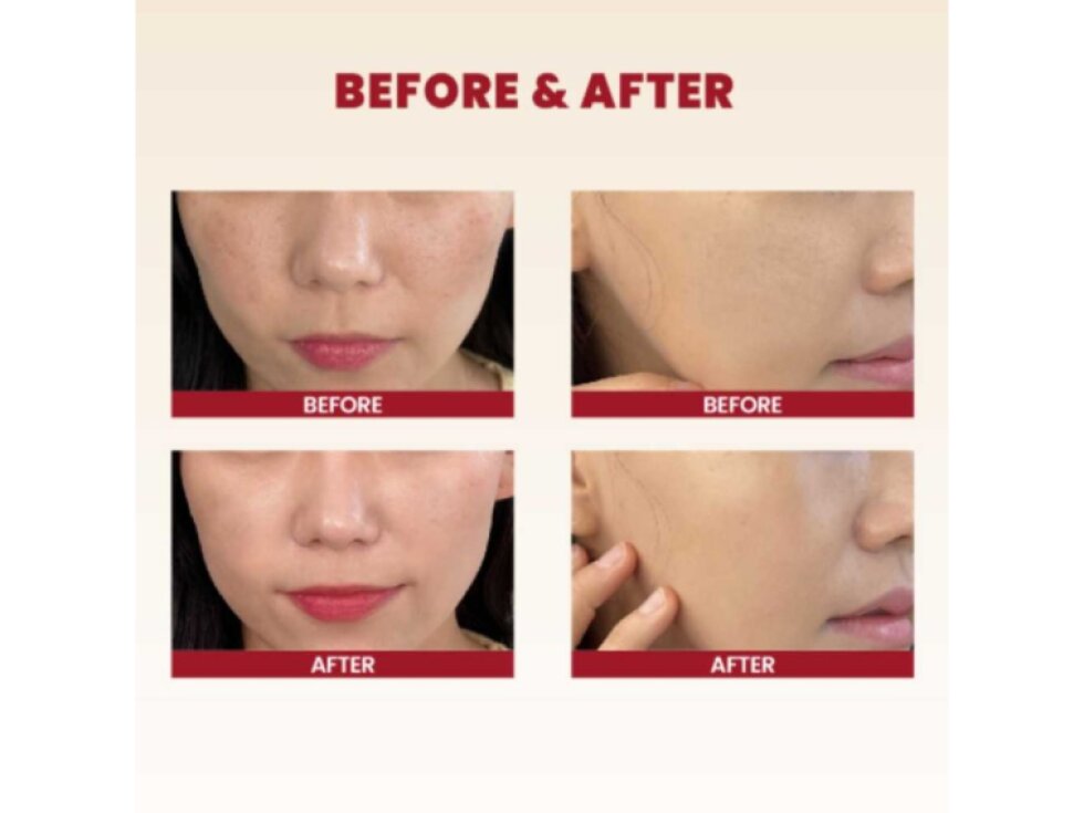 K-SECRET - SEOUL 1988 CREAM SNAIL MUCIN 93% + RICE - Regenerační a rozjasňující pleťový krém se 93 % šnečího mucinu a rýží 100 ml