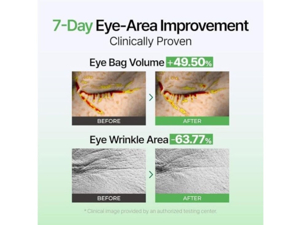 IZEZE - EXOSOME PDRN FIRMING EYE CREAM - Zpevňující a regenerační oční krém s exosomy a PDRN 30 ml