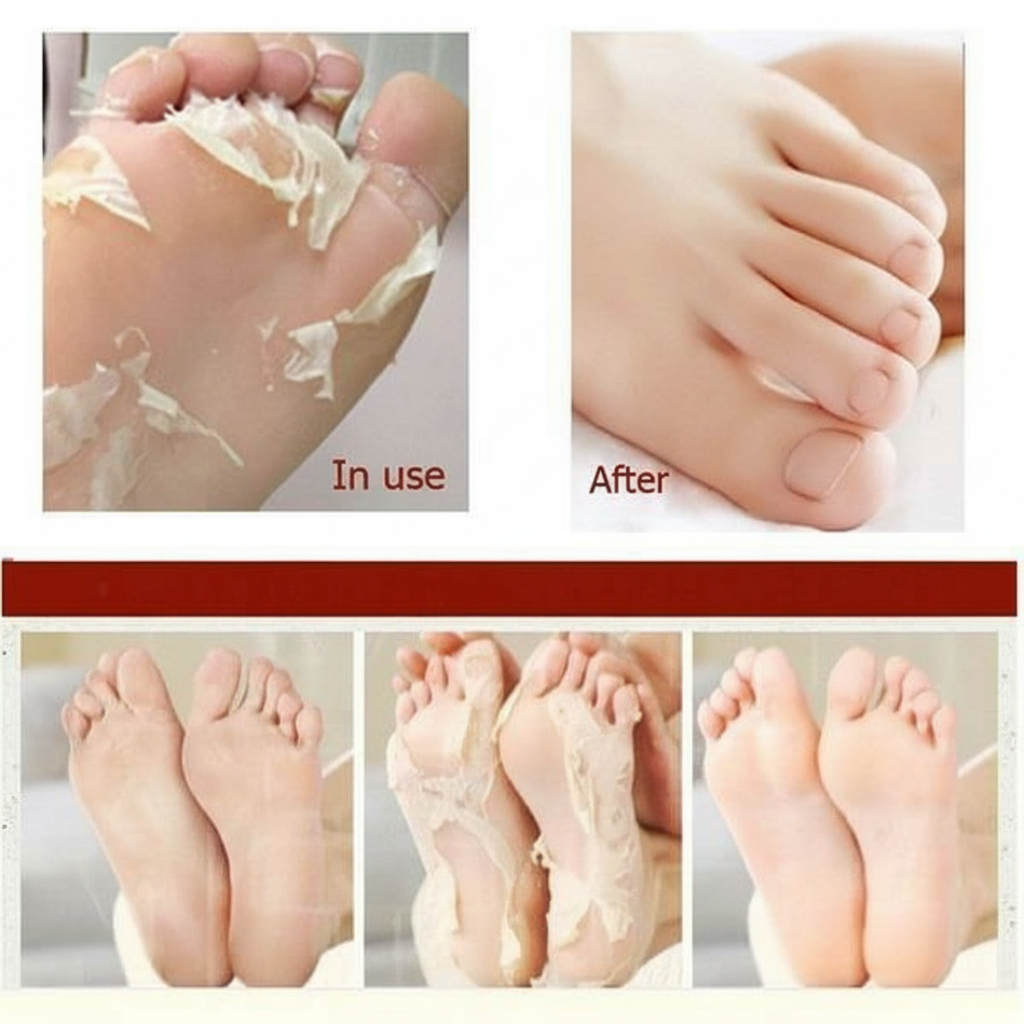 Apieu - Soft Foot Peeling Socks - Exfoliační ponožky na nohy pro jemnější chodidla 1 pár