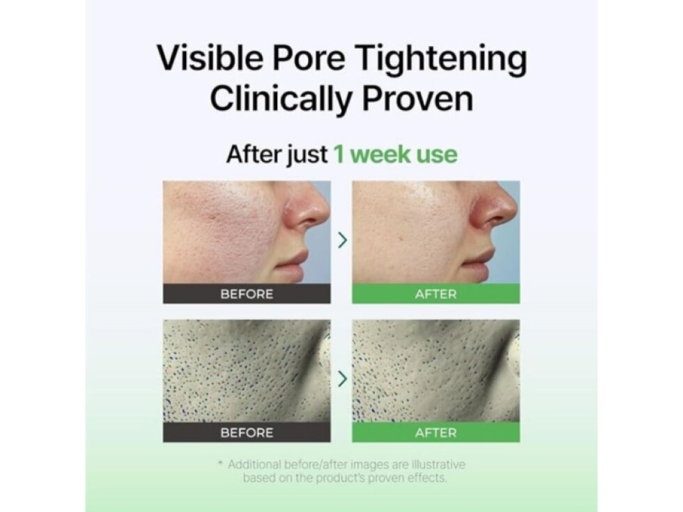 IZEZE - EXOSOME PDRN BOOSTER AMPOULE - Intenzivní regenerační booster ampule s exosomy a PDRN 30 ml