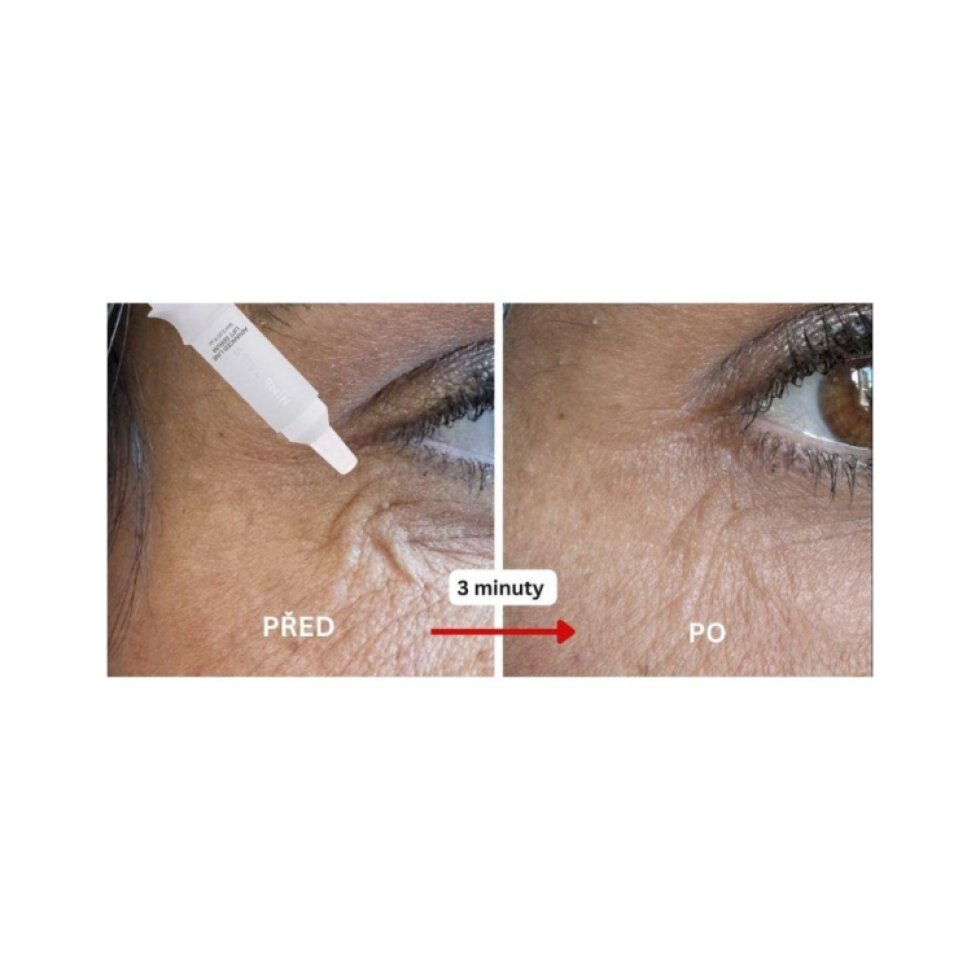 NINE TAILS - ADVANCED LINE LIFT SERUM - Dermální výplň vrásek bez injekce 10 ml
