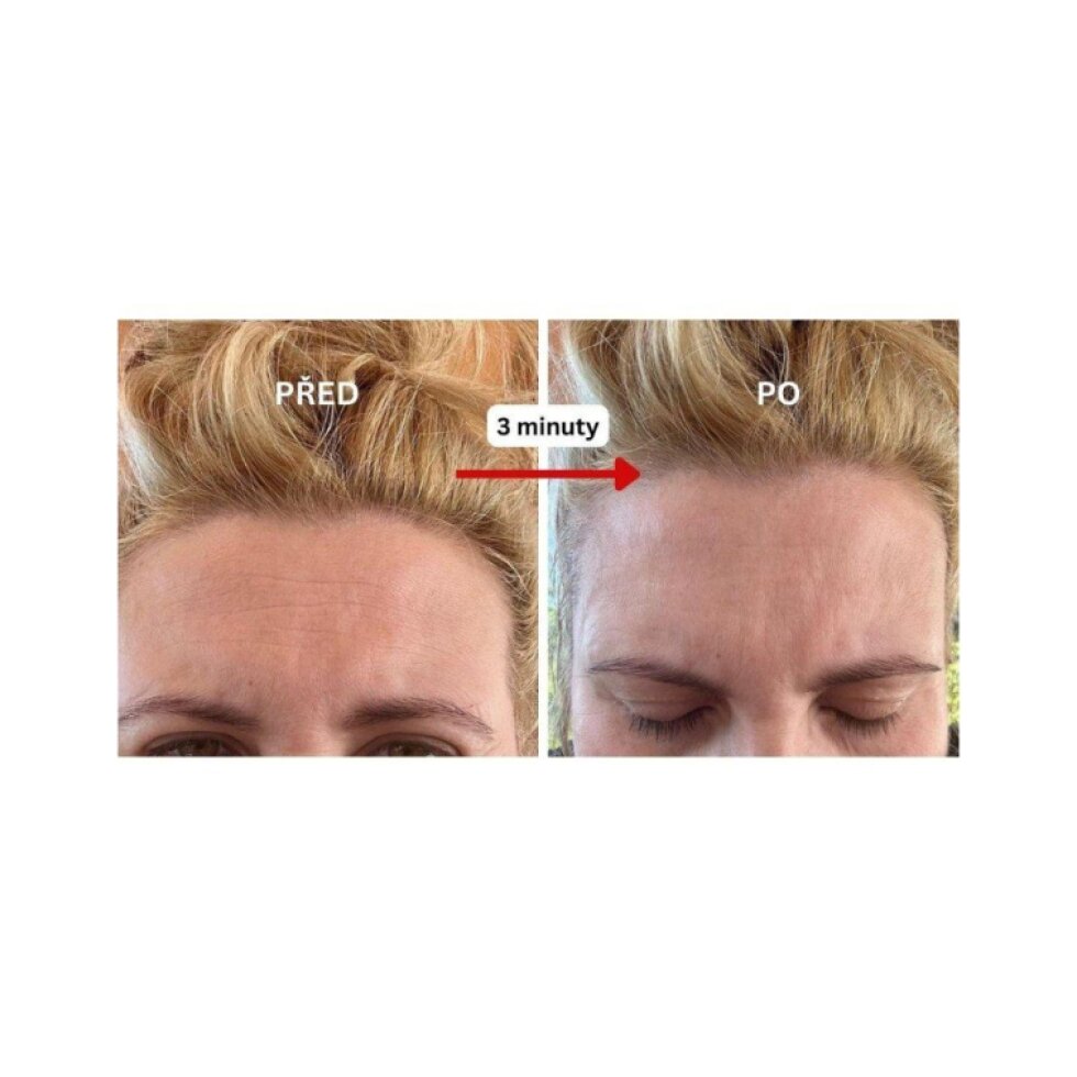 NINE TAILS - ADVANCED LINE LIFT SERUM - Dermální výplň vrásek bez injekce 10 ml