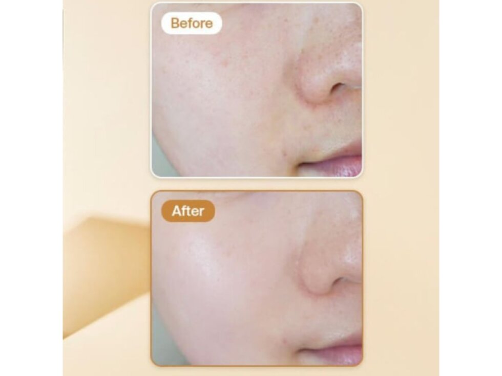 VT - PRO CICA REEDLE SHOT 100 - Zklidňující sérum s technologií REEDLE SHOT a CICA komplexemi 50 ml