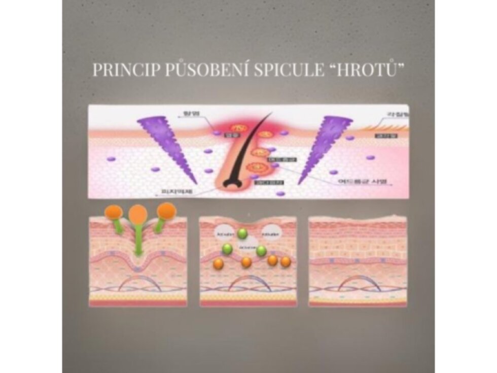 CIESKIN - DERMA G SPICULE ESSENCE - Pleťová esence s aktivními mikrojehličkami 30 ml