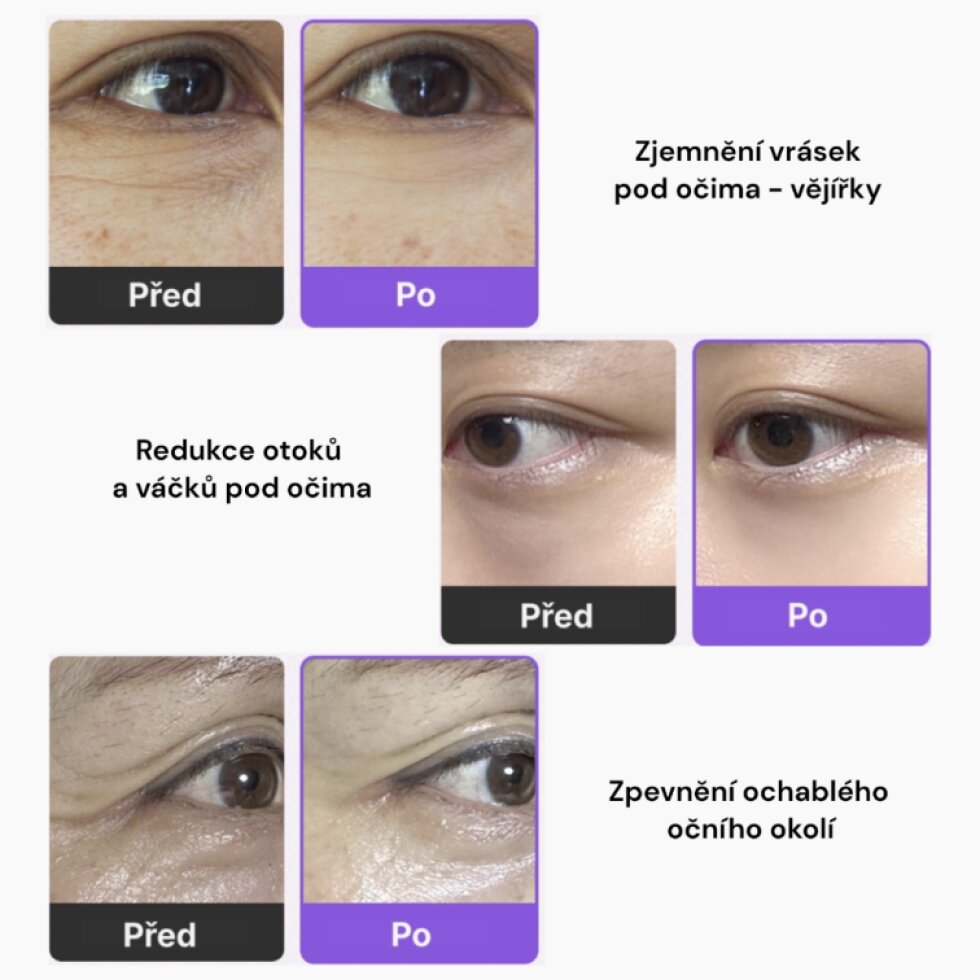 Vella - Eye Patch PDRN 2000 - Tající hydrogelové náplasti pod oči s PDRN 72 g 60 ks