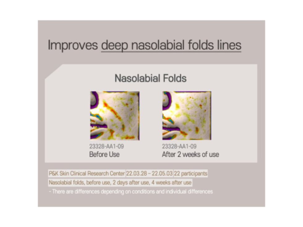 ULTRA V IDEBENONE - PRESTIGE AMPOULE - Super liftingová doufázová ampule 4 x 10 ml