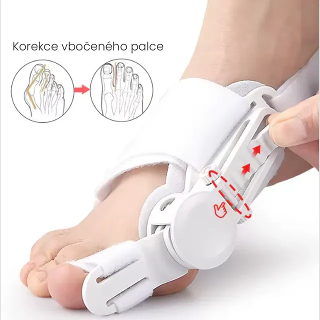 Revoluční trojbalení pro hallux valgus – 2× ortopedická pomůcka + 1× bežový separátor