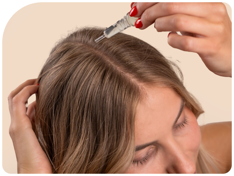 Vlasová voda na androgenetickou alopecii žen Kenogen Donna