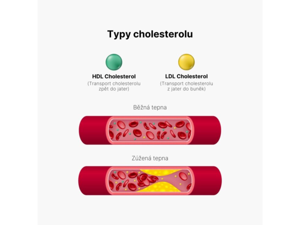 BrainMax Cholesterol Support 100 rostlinných kapslí