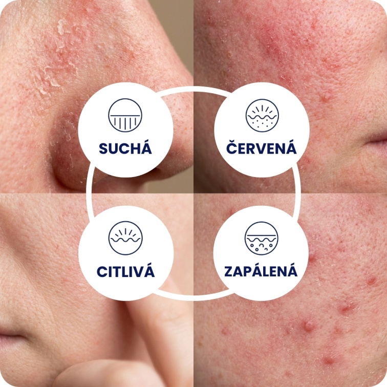 Day Serum INTENZIVNÁ STAROSTLIVOSŤ hubový extrakt 30 ml