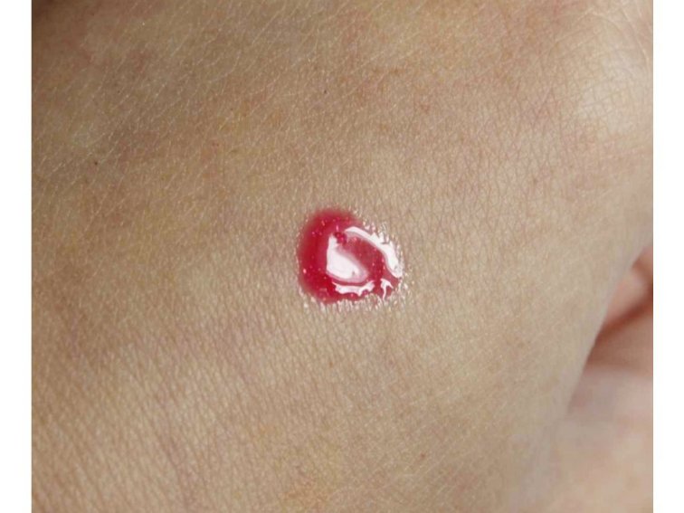 Výhodná sada: Lesk na rty Májový polibek + Summer