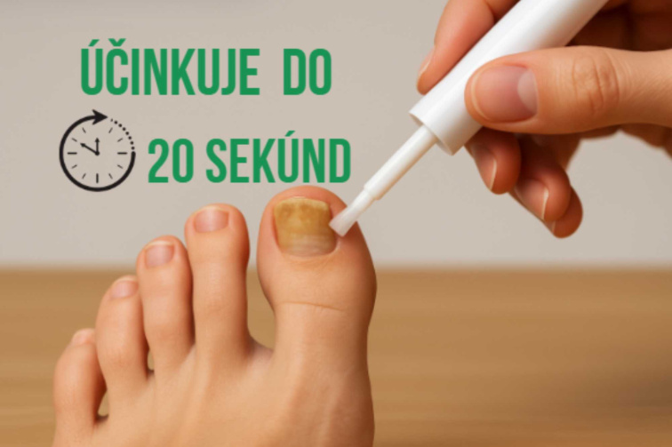 FungeX Prípravok na mykózu nechtov 5ml
