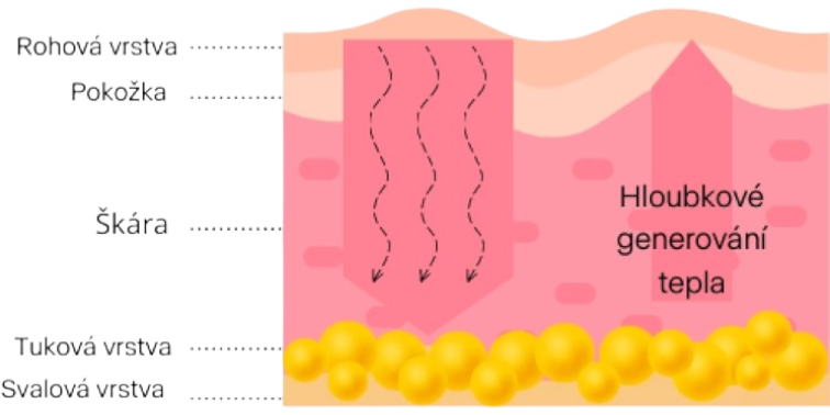 RECLAR RE-MERGE galvanická žehlička