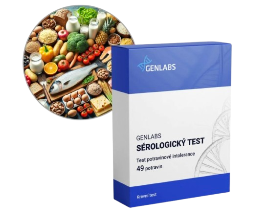 1x Potravinové intolerance 63 potravin