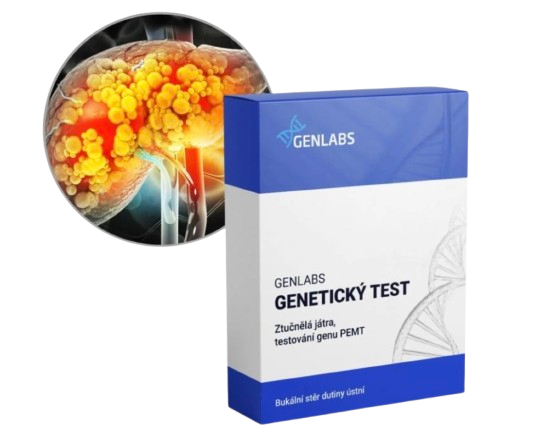 1x Ztučnělá játra (PEMT)