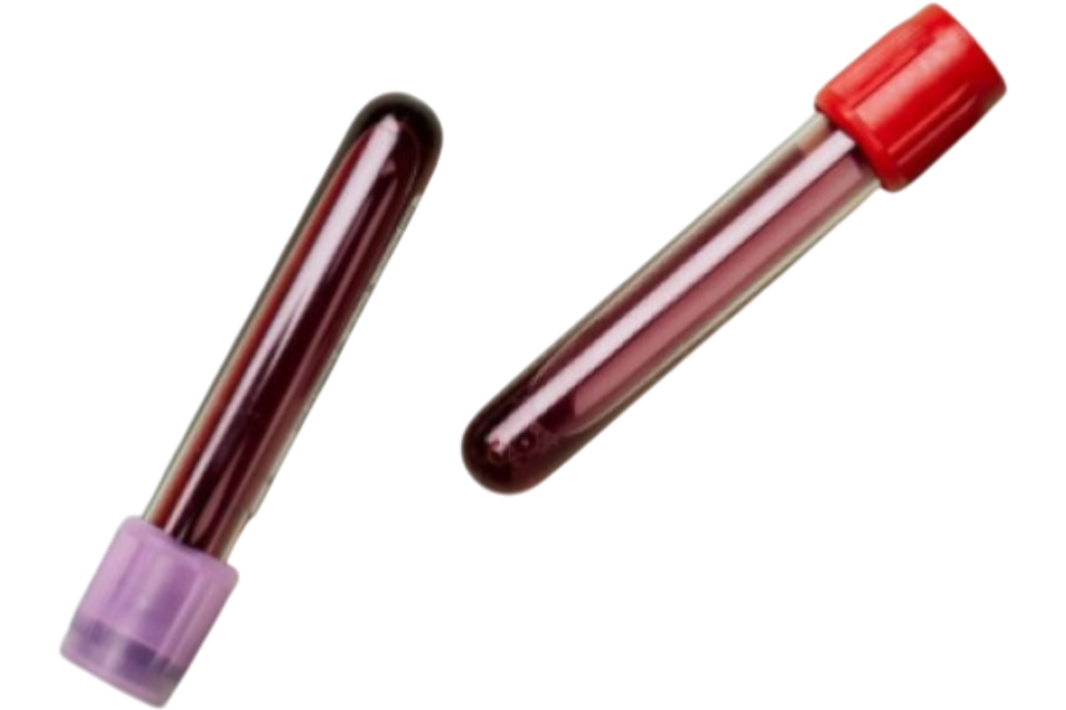 HillVital Salikort balzám, na bolest svalů a zánět šlach, 2x250ml