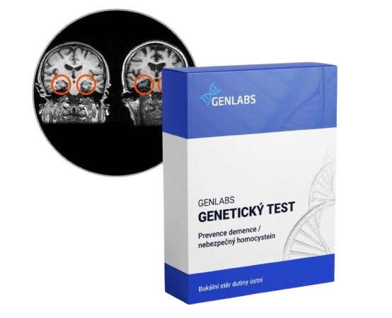 1x Prevence demence, nebezpečný homocystein (COMT, MTHFR, MTRR, MTR a ApoE)