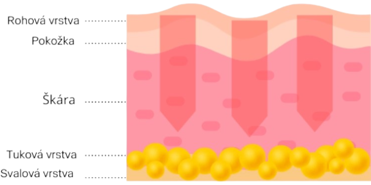 RECLAR RE-MERGE galvanická žehlička