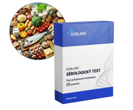 1x Test potravinových intolerancí 20 potravin