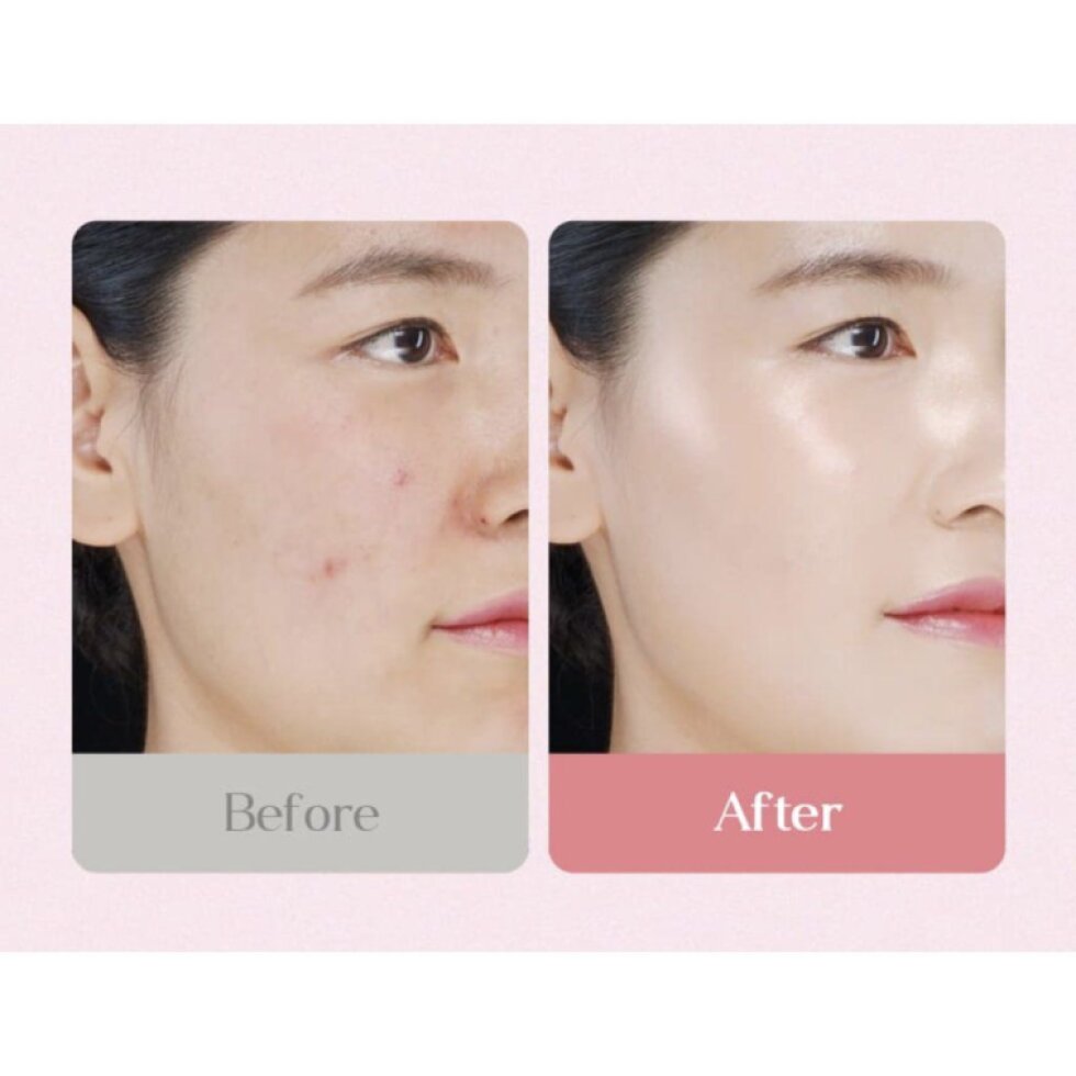 ELROEL - Dot Ampoule Cushion 23 Natural Beige - Cushion make-up s pečujícími složkami a PDRN v odstínu 23 NATURAL BEIGE - 15 g