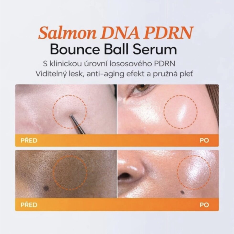 FRANKLY - PDRN Bounce Ball Serum - PDRN sérum z lososa pro mladší vzhled pleti - 30 ml