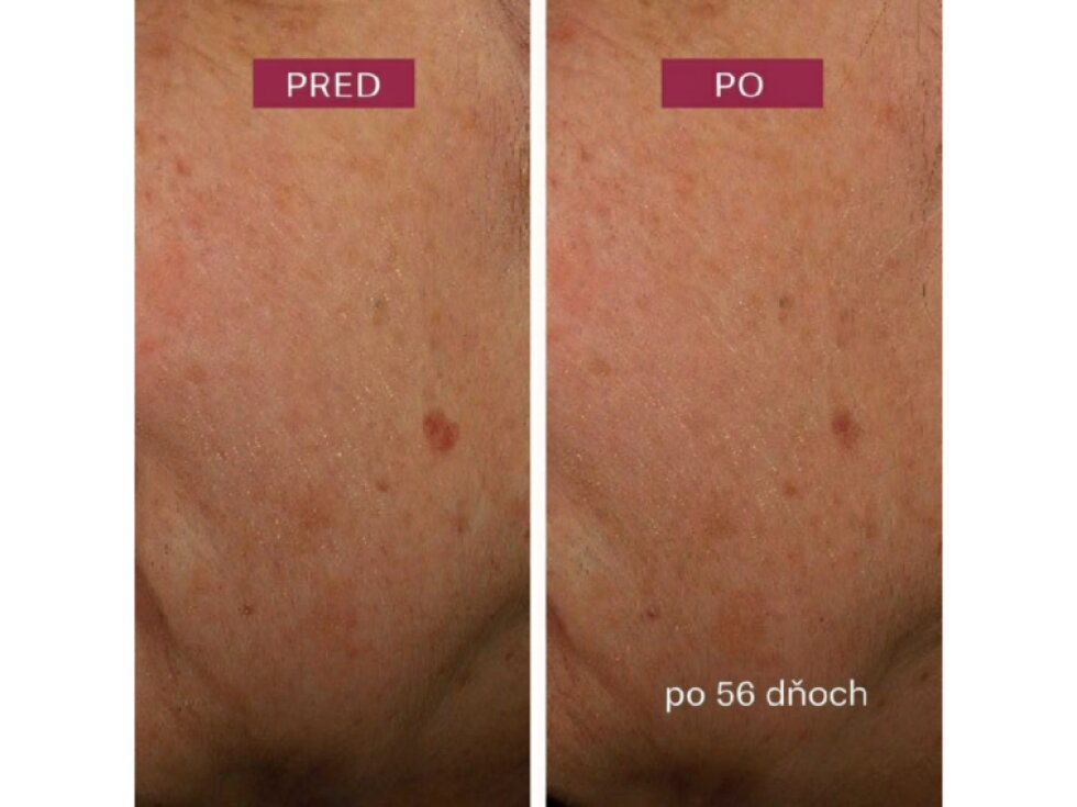 Pleťové sérum Dark Spot
