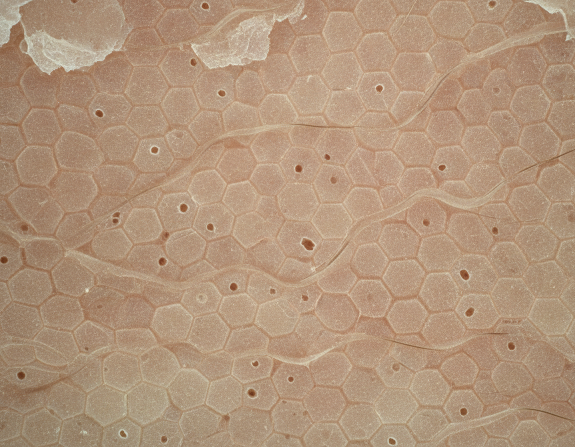 Epiderma