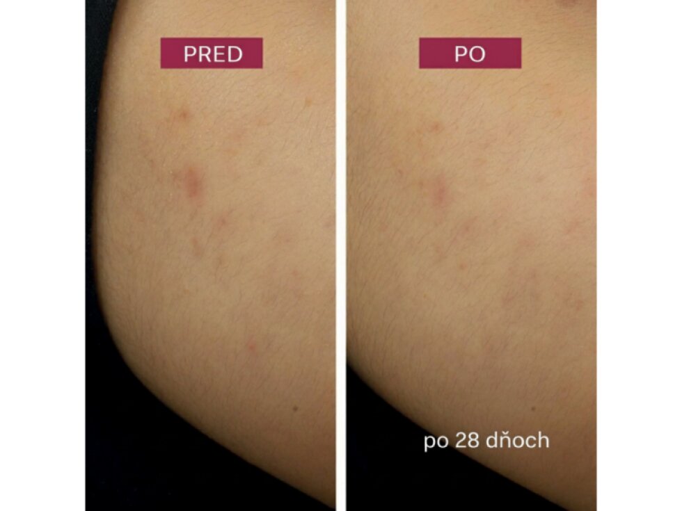 Nočný krém Dark Spot