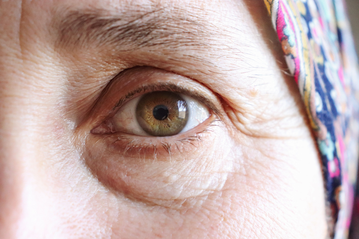 Anti aging: Jak na vyhlazení vrásek, hydrataci a elasticitu pokožky