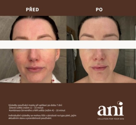 Omlazující LED maska na obličej