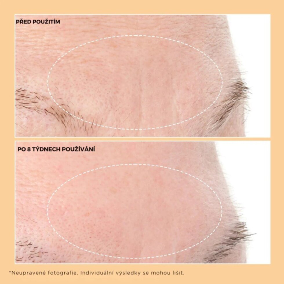 Neuropeptide Hydratační sérum proti hlubokým vráskám, 30 ml