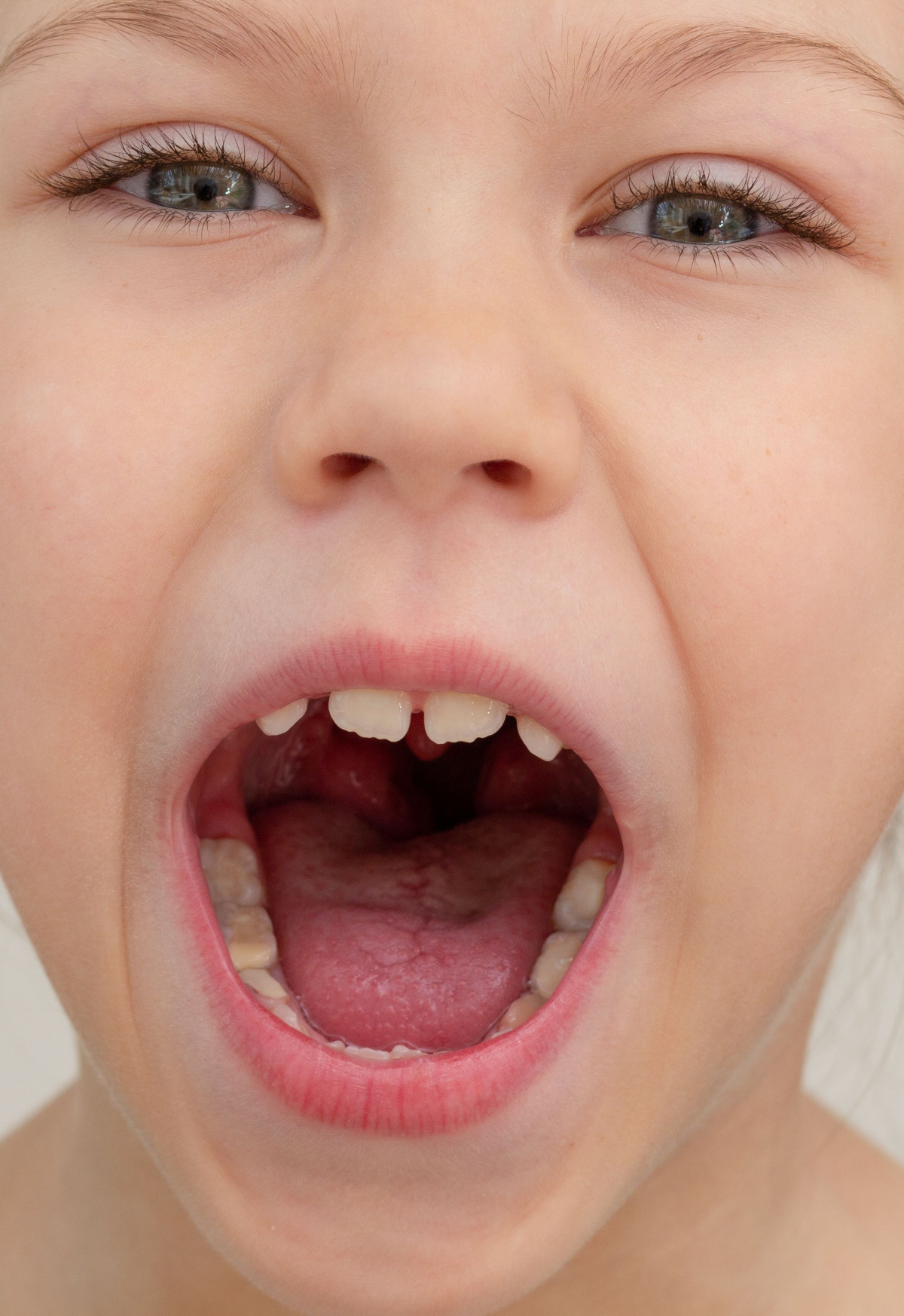 Proč je při myofunkční terapii důležité vnímat jazyk v souvislosti s celým tělem