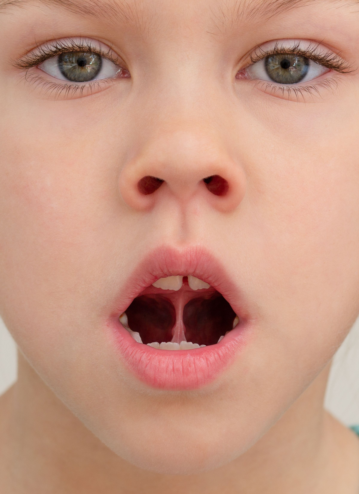 Proč je při myofunkční terapii důležité vnímat jazyk v souvislosti s celým tělem