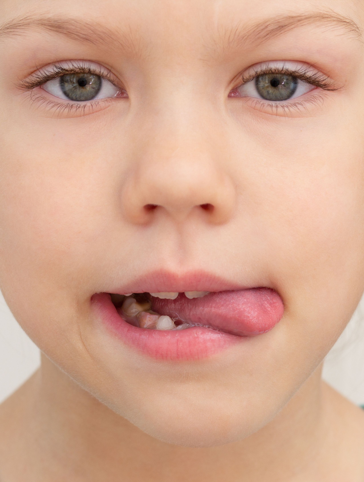 Proč je při myofunkční terapii důležité vnímat jazyk v souvislosti s celým tělem