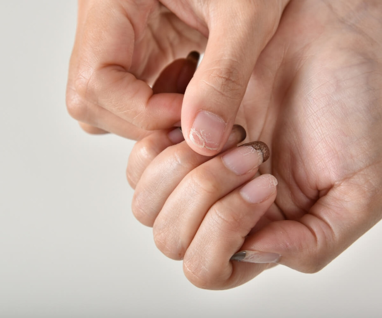 Čo je najlepšie na lámavé nechty? TOP odporúčania pre pevné nechty a najnovšie trendy!