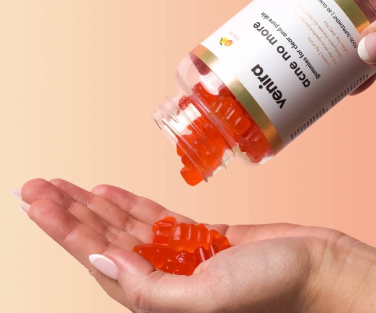 5 mýtov o akné: Väčšina vecí, ktoré ti hovorili, nie je pravda! Ako sa akné konečne zbaviť?