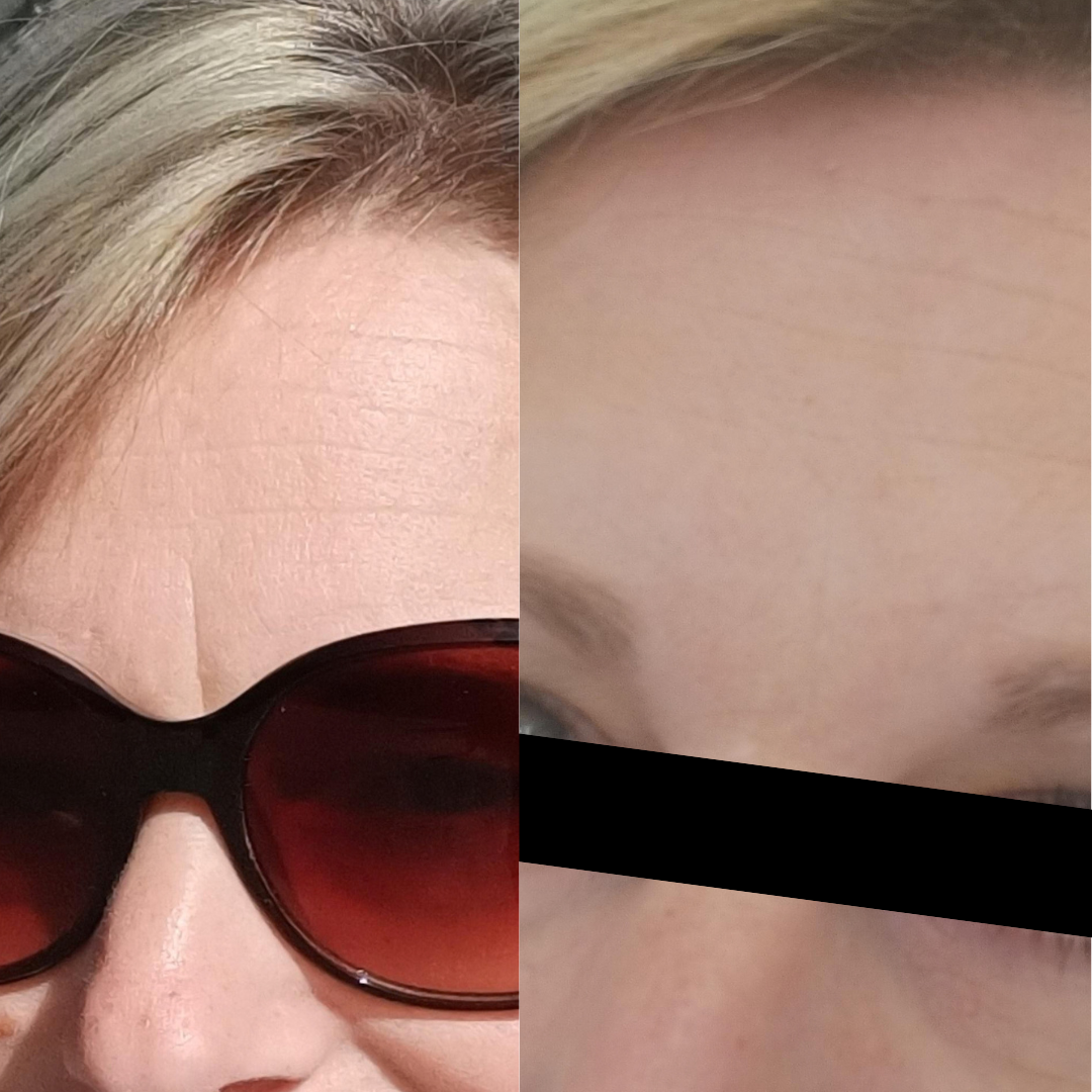 CureTape® Beauty pro tejpování obličeje