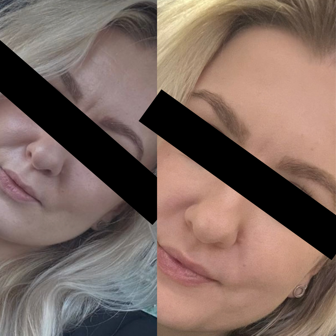 CureTape® Beauty pro tejpování obličeje